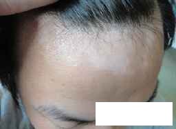 ¹óÖݰ×ñ°·çÖÎÁÆÄÄÀïЧ¹ûºÃ