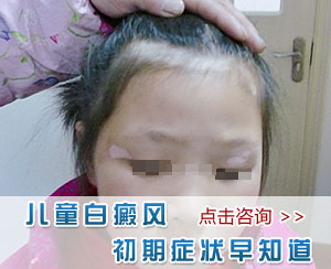 儿童白癜风的早期症状有哪些?