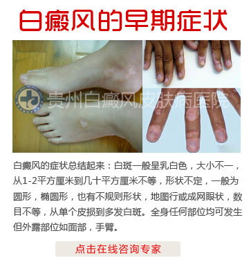 白癜风的早期症状有哪些?