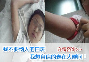 儿童白癜风患者在治疗上需要避免三大误区