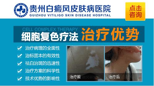 白癜风治疗偏方可信吗?